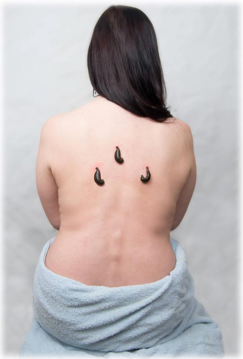 Kaaniravi ehk hirudoteraapia viie korra tervisekuur 