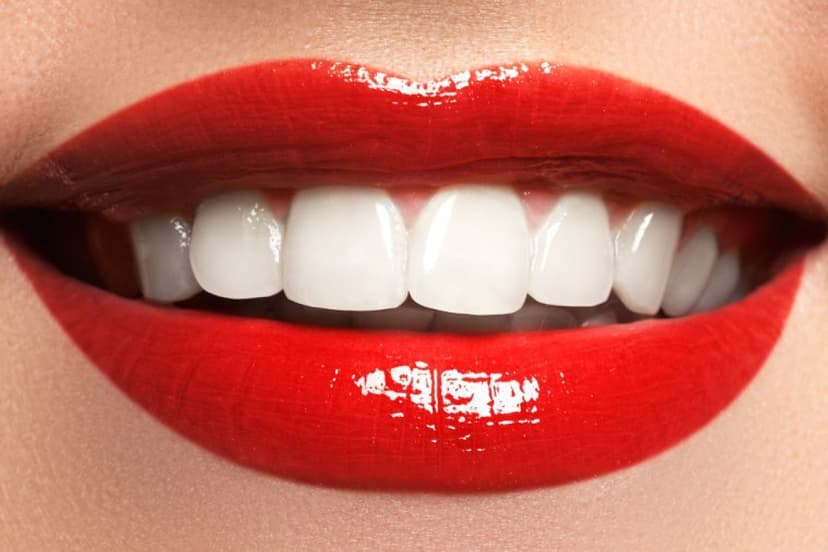 Hammaste fotovalgendus