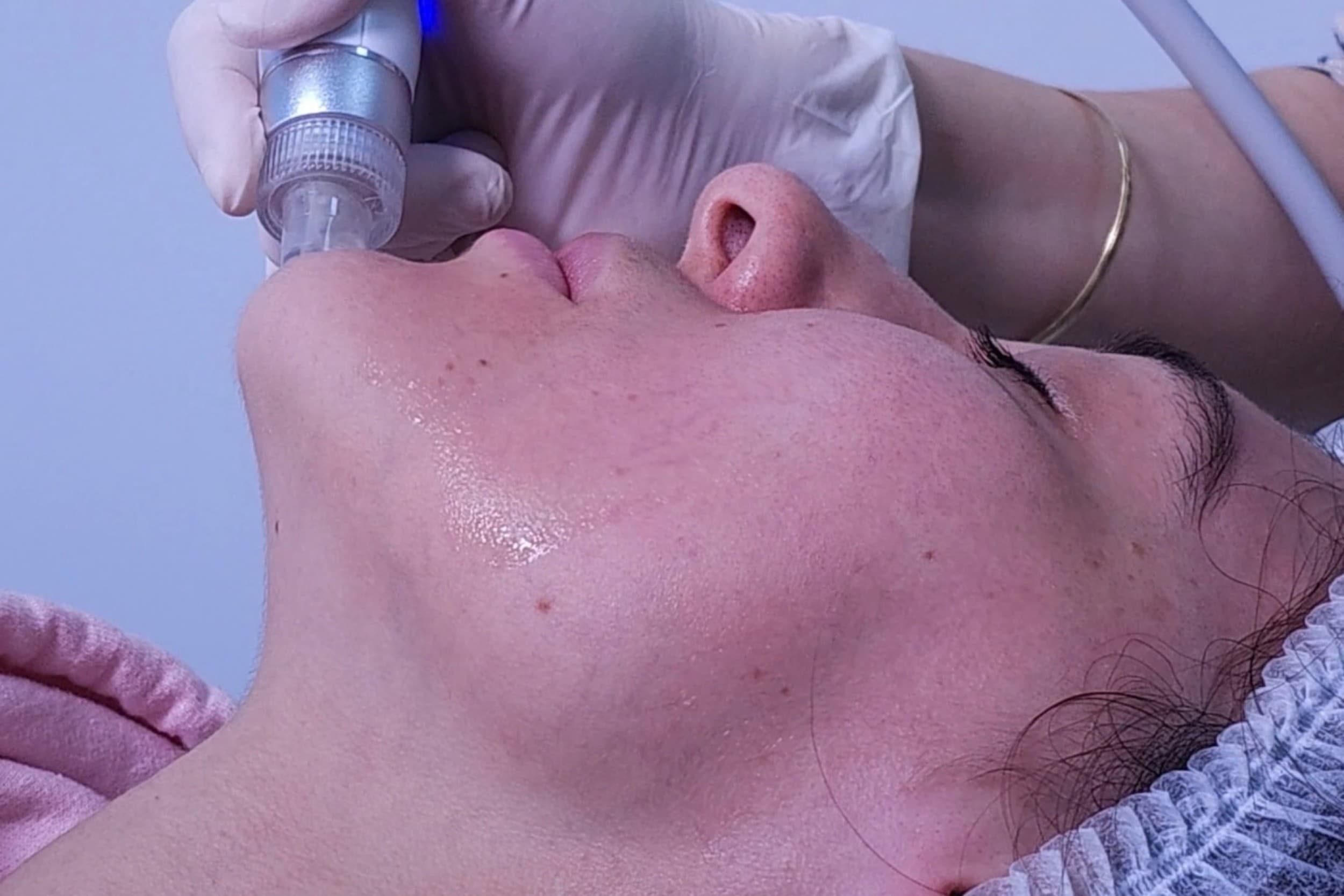 Luksuslik näohooldus Premium Glow - Hydro Facial & RF-lifting