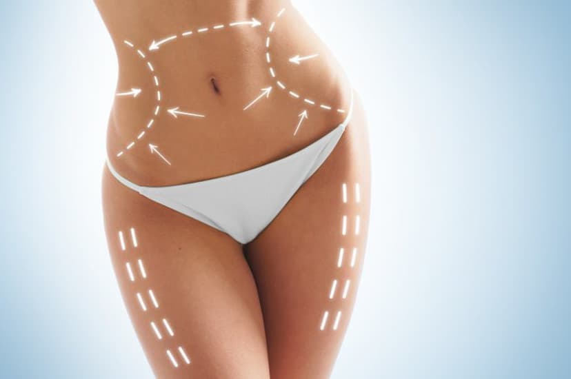 Ühe tsooni krüolipolüüs ja terve keha pressoteraapia