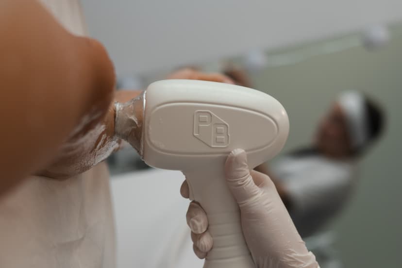 "Glamuur" laserepilatsiooni pakett